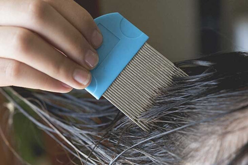 How To Get Rid Of Head Lice-Lice-Comb