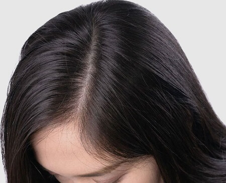 a_girl_with_a_very_healthy_scalp