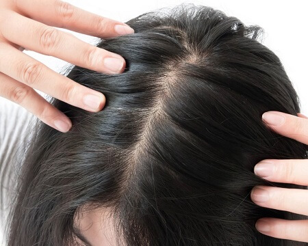 How Can I Get My Hair To Stop Thinning?-Blog - 